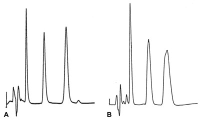What is your explanation for the broad peaks? What can you suggest to solve the problem? 