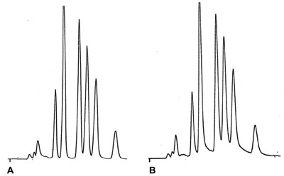 What is the problem in chromatogram B? 